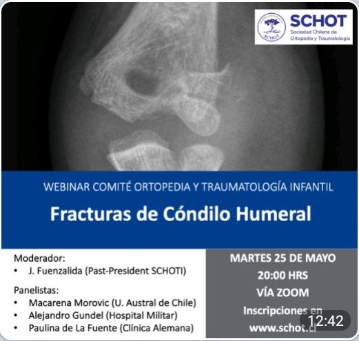 Webinar: Fracturas de Cóndilo Humeral – SCHOT